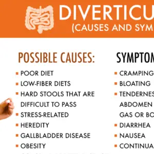 Diverticulitis