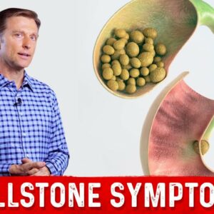 Gallstones